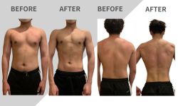 ビフォアフ　オオト様