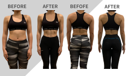 ビフォアフ　シバタ様１