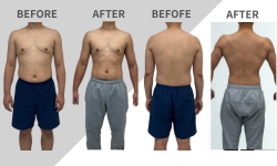 ビフォアフ　トガシ様２